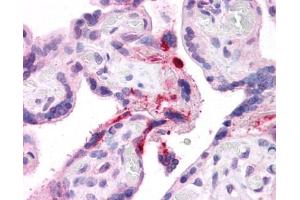 LRRC8B antibody was used for immunohistochemistry at a concentration of 4-8 ug/ml.