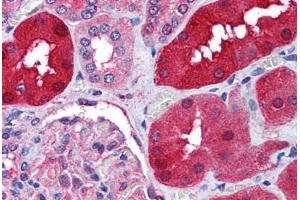 Human Kidney (formalin-fixed, paraffin-embedded) stained with RNF213 antibody ABIN290404 at 1. (RNF213 anticorps  (AA 5191-5204))