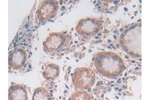 Detection of UTRN in Human Stomach Tissue using Polyclonal Antibody to Utrophin (UTRN)