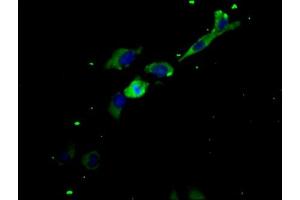 Immunofluorescence staining of Hela cells with ABIN7158226 at 1:200, counter-stained with DAPI. (LIFR anticorps  (AA 915-1086))