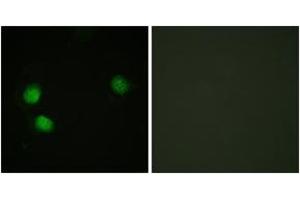 Immunofluorescence analysis of HeLa cells, using Bloom Syndrome (Phospho-Thr99) Antibody. (Bloom Syndrome (AA 65-114), (pThr99) anticorps)