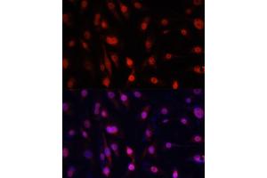 Immunofluorescence analysis of HeLa cells using YB-1/YB-1/YBX1 antibody (ABIN7271411) at dilution of 1:100.