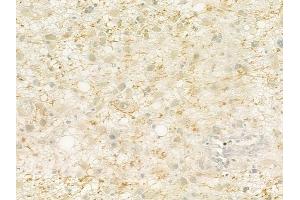 ABIN6260884 and ABIN6279308 at 1/100 staining human astrocytoma by IHC-P. (Claudin 23 anticorps  (Internal Region))
