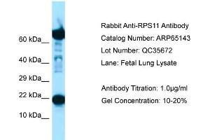 Western Blotting (WB) image for anti-Ribosomal Protein S11 (RPS11) (C-Term) antibody (ABIN2790056) (RPS11 anticorps  (C-Term))