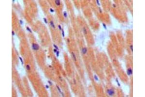 Immunohistochemical analysis of paraffin-embedded human normal myocardium, showing cytoplasmic localization using NPPB monoclonal antibody, clone 3A6F7C7  with DAB staining. (NPPB anticorps)