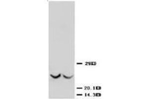 Western blot analysis of rat kidney tissue lysis using TIMP3 antibody (TIMP3 anticorps  (C-Term))