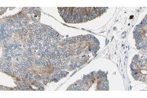 ABIN6276417 at 1/100 staining Human prostate tissue by IHC-P. (JUP anticorps  (C-Term))