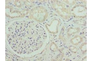 Immunohistochemistry of paraffin-embedded human kidney tissue using ABIN7171040 at dilution of 1:100 (SUSD6 (AA 144-303) anticorps)