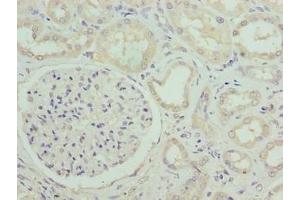 Immunohistochemistry of paraffin-embedded human kidney tissue using ABIN7171040 at dilution of 1:100 (SUSD6 (AA 144-303) anticorps)