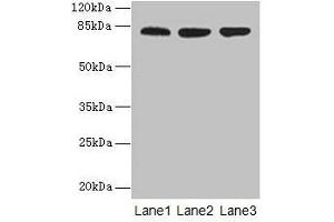 Western blot All lanes: ACAP1 antibody at 4 μg/mL Lane 1: Mouse lung tissue Lane 2: Jurkat whole cell lysate Lane 3: K562 whole cell lysate Secondary Goat polyclonal to rabbit IgG at 1/10000 dilution Predicted band size: 82 kDa Observed band size: 82 kDa (ACAP1 anticorps  (AA 1-266))