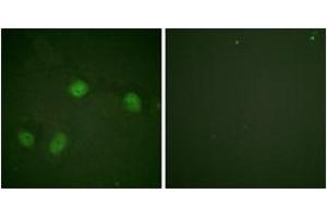 Immunofluorescence analysis of HeLa cells, using C-RAF (Phospho-Ser621) Antibody. (RAF1 anticorps  (pTyr621))