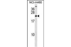 Western blot analysis in NCI-H460 cell line lysates (35ug/lane). (RPS16 anticorps  (AA 45-74))