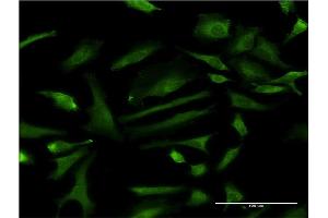 Immunofluorescence of monoclonal antibody to ZNF274 on HeLa cell. (ZNF274 anticorps  (AA 420-530))