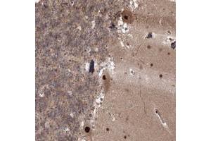 Immunohistochemical staining of human cerebellum with COPS4 polyclonal antibody  shows strong nuclear and cytoplasmic positivity in Purkinje cells at 1:20-1:50 dilution. (COPS4 anticorps)