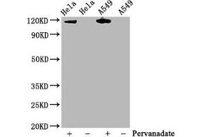 Western Blot Positive WB detected in Hela whole cell lysate,A549 whole cell lysate(treated with Pervanadate or not) All lanes Phospho-JAK2 antibody at 0.