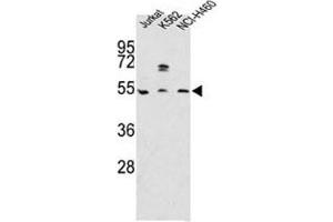 Western blot analysis of APOA4 antibody and Jurkat, K562, NCI-H460 lysate (APOA4 anticorps  (AA 49-79))