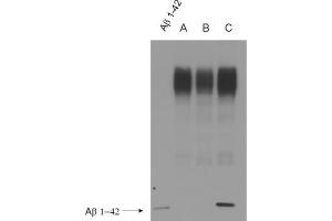 WB detection (ECL) of Abeta peptides (dilution 1 : 500). (Abeta 38/40/42 (AA 1-16), (AA 4-8) anticorps)