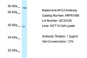 Western Blotting (WB) image for anti-Replication Factor C (Activator 1) 2, 40kDa (RFC2) (N-Term) antibody (ABIN2788844) (RFC2 anticorps  (N-Term))
