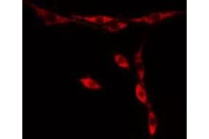 ABIN6276439 staining  HuvEc cells by IF/ICC.