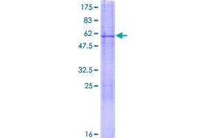 Image no. 1 for Chromodomain Protein, Y-Like (CDYL) (AA 1-309) protein (GST tag) (ABIN1349062)