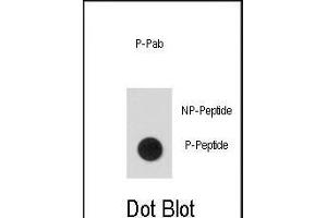 Dot blot analysis of anti-Phospho-hSTAT5a-p Phospho-specific Antibody (ABIN389667 and ABIN2839646) on nitrocellulose membrane. (STAT5A anticorps  (pSer726))