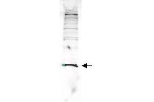 Image no. 1 for anti-Parkinson Protein 7 (PARK7) (AA 177-189) antibody (ABIN401278)