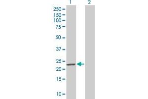 Western Blot analysis of MND1 expression in transfected 293T cell line by MND1 MaxPab polyclonal antibody. (MND1 anticorps  (AA 1-205))