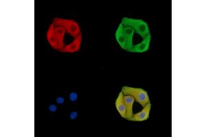 ABIN7095715 and ABIN7099777 staining Hela cells by IF/ICC.