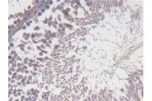 Detection of CYP17A1 in Rat Testis Tissue using Polyclonal Antibody to Cytochrome P450 17A1 (CYP17A1)