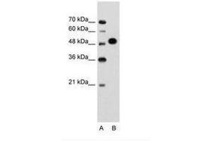 Image no. 1 for anti-Makorin Ring Finger Protein 1 (MKRN1) (AA 101-150) antibody (ABIN203479) (MKRN1 anticorps  (AA 101-150))