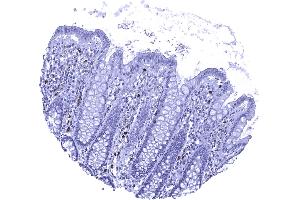 Colon descendes mucosa In the normal colon MPO positive granulocytes occur within small capillaries and also the stroma of the lamina propria (Myeloperoxidase anticorps)
