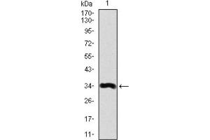Western blot analysis using LPA antibody against human LPA recombinant protein. (Lp(a) anticorps  (AA 4330-4521))