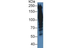 Western blot analysis of Human HeLa cell lysate, using Human PPL Antibody (5 µg/ml) and HRP-conjugated Goat Anti-Rabbit antibody ( (PPL anticorps  (AA 1439-1716))