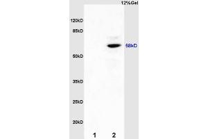 L1 mouse kidney lysates L2 mouse brain lysates probed with Anti ER-beta Polyclonal Antibody, Unconjugated (ABIN725210) at 1:200 overnight at 4 °C. (ESR2 anticorps  (AA 201-300))