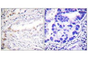 Immunohistochemistry (IHC) image for anti-SUMO1 Activating Enzyme Subunit 2 (UBA2) (C-Term) antibody (ABIN1848872) (UBA2 anticorps  (C-Term))