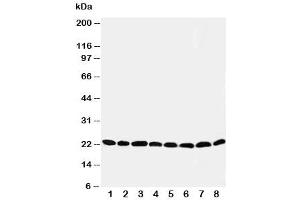 Western blot testing of Peroxiredoxin 5 antibody and Lane 1:  rat brain (Peroxiredoxin 5 anticorps  (C-Term))