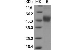Western Blotting (WB) image for Interleukin 2 Receptor, beta (IL2RB) protein (His tag) (ABIN7196470)