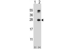 Western blot analysis of DHFR antibody and 293 cell lysate either nontransfected (Lane 1) or transiently transfected (2) with the DHFR gene.