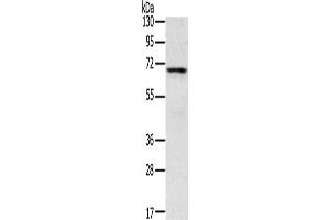 Gel: 8 % SDS-PAGE, Lysate: 40 μg, Lane: Human fetal brain tissue, Primary antibody: ABIN7192841(TNK1 Antibody) at dilution 1/400, Secondary antibody: Goat anti rabbit IgG at 1/8000 dilution, Exposure time: 5 minutes (TNK1 anticorps)