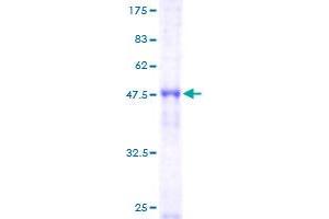 Image no. 1 for Origin Recognition Complex, Subunit 4 (ORC4) (AA 1-248) protein (GST tag) (ABIN1313656)