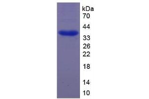 Image no. 1 for cAMP Responsive Element Binding Protein 1 (CREB1) (AA 102-341) protein (His tag) (ABIN4988664) (CREB1 Protein (AA 102-341) (His tag))