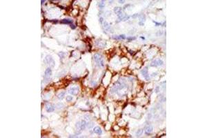 Image no. 2 for anti-PAK3 (PAK3) (Middle Region) antibody (ABIN360320)