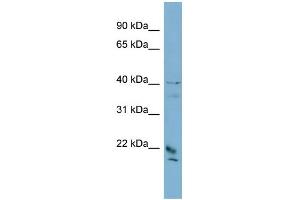 WB Suggested Anti-DYDC1 Antibody Titration: 0. (DYDC1 anticorps  (Middle Region))