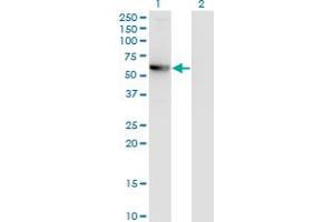 Western Blot analysis of CCDC83 expression in transfected 293T cell line by MGC34732 monoclonal antibody (M01), clone 3E3.