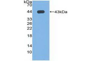 Detection of Recombinant PLD, Human using Polyclonal Antibody to Phospholipase D (PLD) (Phospholipase D anticorps  (AA 725-1074))