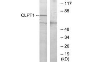 Western Blotting (WB) image for anti-Cleft Lip and Palate Associated Transmembrane Protein 1 (CLPTM1) (AA 200-249) antibody (ABIN2890759) (CLPTM1 anticorps  (AA 200-249))