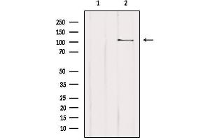 Western blot analysis of extracts from Hybridoma cells, using MTHFD1L Antibody. (MTHFD1L anticorps  (C-Term))