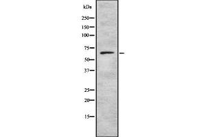 Western blot analysis of Collagen VIII α2 using LOVO whole cell lysates (COL8a2 anticorps  (Internal Region))