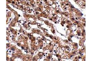 Immunohistochemistry of MACC1 in human lung tissue with MACC1 polyclonal antibody  at 2.