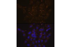 Immunofluorescence analysis of C6 cells using Phospholipid Phospholipid Scramblase 1 (PLSCR1) (PLSCR1) Rabbit mAb (ABIN7269354) at dilution of 1:100 (40x lens). (PLSCR1 anticorps)